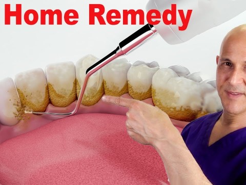 #1 Home Remedy to Remove Dental Plaque & Tarter to Prevent Cavities | Dr. Mandell #1 Home Remedy to Remove Dental Plaque & Tarter to Prevent Cavities | Dr. Mandell
