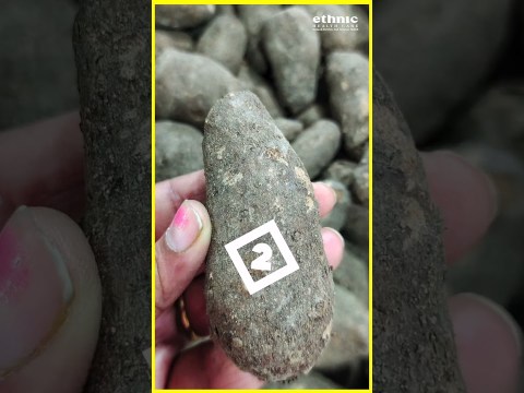 Top 5 Tips to cure PILES Permanently | மூல நோய்க்கு நிரந்தர தீர்வு 5 டிப்ஸ் #piles #pilestreatment Top 5 Tips to cure PILES Permanently | மூல நோய்க்கு நிரந்தர தீர்வு 5 டிப்ஸ் #piles #pilestreatment