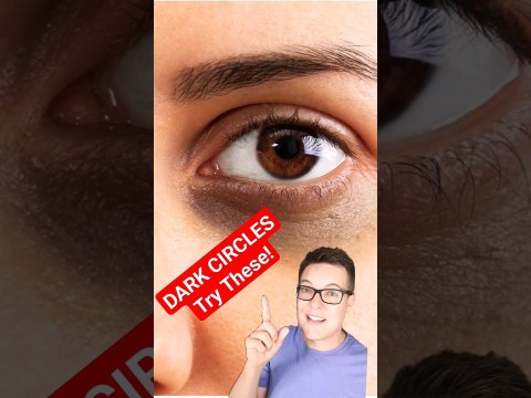DARK CIRCLES – Skincare For Instant Results #shorts DARK CIRCLES – Skincare For Instant Results #shorts