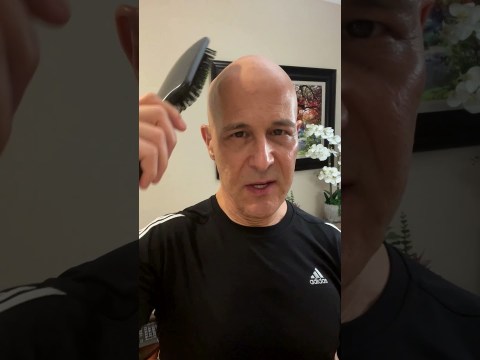 Simple Remedies For Balding & Hair Loss | Dr. Mandell Simple Remedies For Balding & Hair Loss | Dr. Mandell