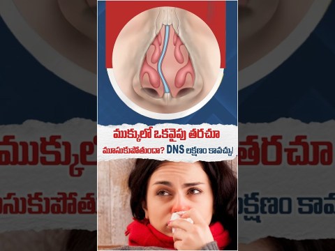 Deviated Nasal Septum Causes And Symptoms | Nose Blockage Treatment Details | Asian ENT Care Centre Deviated Nasal Septum Causes And Symptoms | Nose Blockage Treatment Details | Asian ENT Care Centre