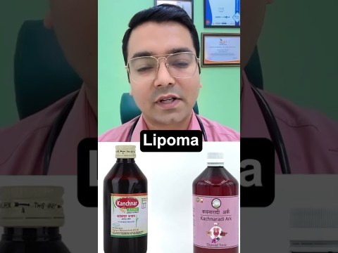 Treatment of Lipoma! #shorts Treatment of Lipoma! #shorts