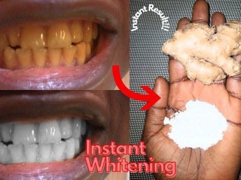 In just two minutes, white teeth whiten and shiny like pearls, the best natural remedies treatment In just two minutes, white teeth whiten and shiny like pearls, the best natural remedies treatment