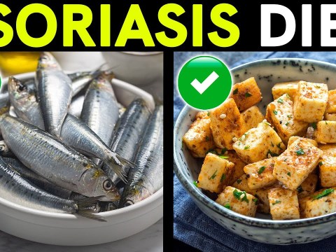 Psoriasis Treatment and Diet: Foods to Eat and Avoid Psoriasis Treatment and Diet: Foods to Eat and Avoid