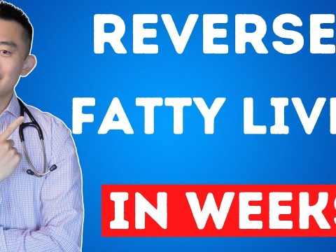 The FASTEST Way to Reverse Fatty Liver, Naturally | NAFLD Treatment The FASTEST Way to Reverse Fatty Liver, Naturally | NAFLD Treatment