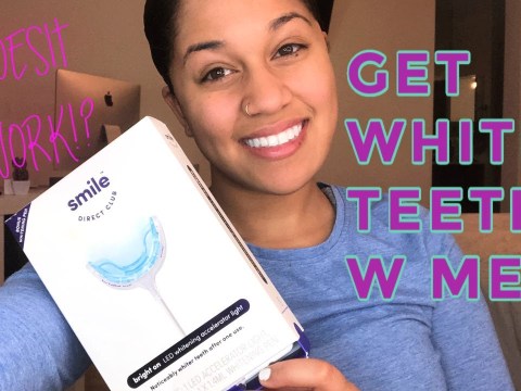 SMILE DIRECT CLUB WHITENING REVIEW SMILE DIRECT CLUB WHITENING REVIEW