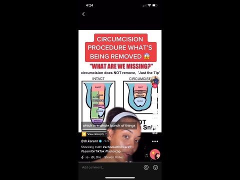 Circumcision procedure: what's being removed? #shorts Circumcision procedure: what's being removed? #shorts