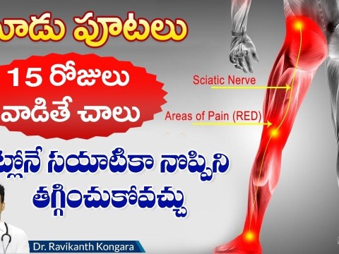 What is Sciatica Pain | How to Get Sciatica Pain Relief | MRI Scan | Surgery | Dr. Ravikanth Kongara What is Sciatica Pain | How to Get Sciatica Pain Relief | MRI Scan | Surgery | Dr. Ravikanth Kongara