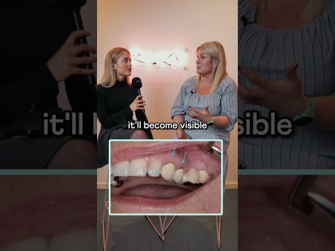 How long does a dental bridge last? #dentist #qanda #dental #bridge #lifespan #health #gums How long does a dental bridge last? #dentist #qanda #dental #bridge #lifespan #health #gums