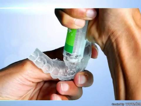 Meodental Natural+ whitening, Home Kit procedure video Meodental Natural+ whitening, Home Kit procedure video