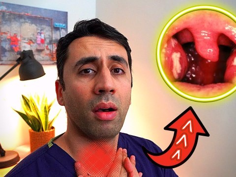 What Causes a Sore Throat? HOME Remedies and Cures for Fast TREATMENT| Doctor Explains What Causes a Sore Throat? HOME Remedies and Cures for Fast TREATMENT| Doctor Explains