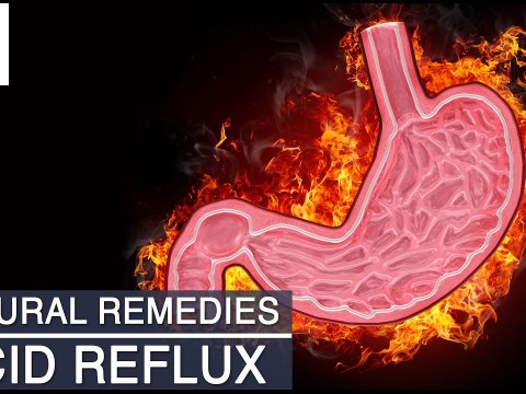 Acid Reflux (Acidity) – Natural Ayurvedic Home Remedies Acid Reflux (Acidity) – Natural Ayurvedic Home Remedies