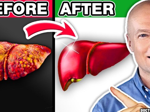 #1 Absolute Best FATTY LIVER DETOX #1 Absolute Best FATTY LIVER DETOX