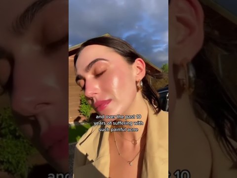 Accutane didn’t heal my hormonal acne, but this did. #shorts #acne #hormonalacne Accutane didn’t heal my hormonal acne, but this did. #shorts #acne #hormonalacne