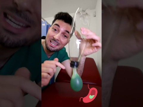 How to get rid of acid reflux and treatment home remedy stop #shorts How to get rid of acid reflux and treatment home remedy stop #shorts