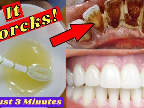 Proven Method for your Healthy Teeth | teeth whitening hacks | get whiten teeth at home in 3 minutes Proven Method for your Healthy Teeth | teeth whitening hacks | get whiten teeth at home in 3 minutes