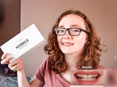 HiSmile Teeth Whitening Kit Review | Is It Worth It? HiSmile Teeth Whitening Kit Review | Is It Worth It?