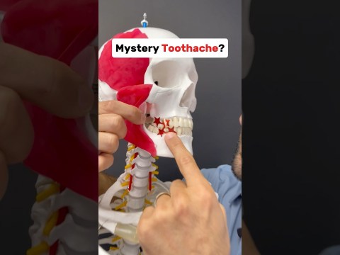 Mystery tooth ache? It could be a muscle! #tmj Mystery tooth ache? It could be a muscle! #tmj