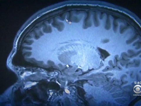 New Treatment For OCD New Treatment For OCD