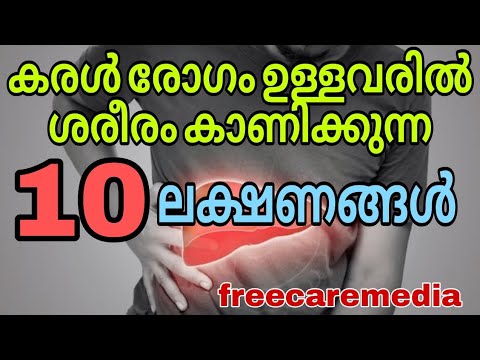 Liver disease symptoms malayalam Liver disease symptoms malayalam