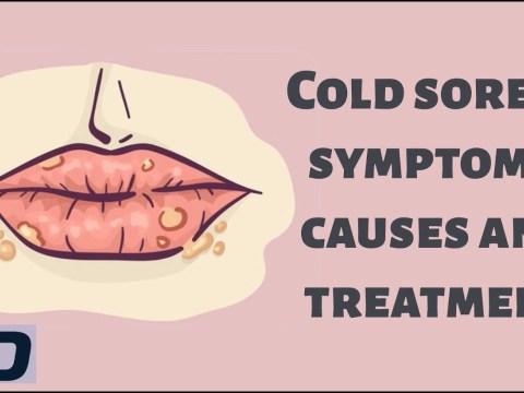 Cold Sores – Symptoms, Causes and Treatment Cold Sores – Symptoms, Causes and Treatment