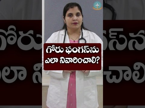 toenail fungus home remedies || Dr. Deepthi Kareti toenail fungus home remedies || Dr. Deepthi Kareti