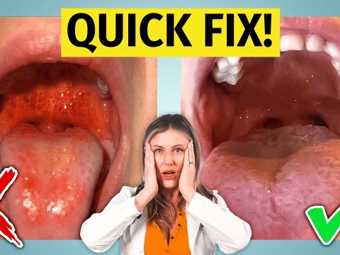 Strep Throat – treat it fast (learn how) Strep Throat – treat it fast (learn how)