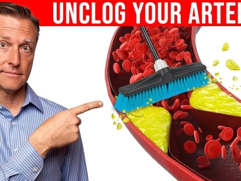The #1 Best Remedy to Clean Plaque From Your Arteries The #1 Best Remedy to Clean Plaque From Your Arteries