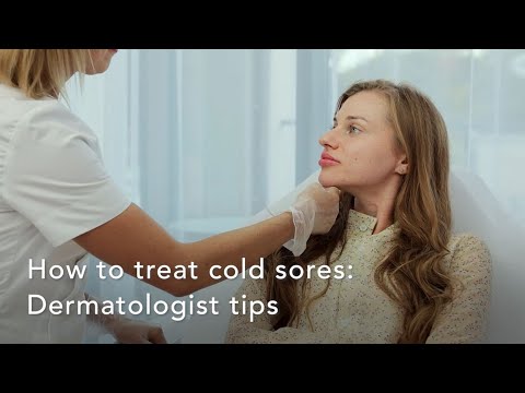 How to treat cold sores: Dermatologist tips How to treat cold sores: Dermatologist tips