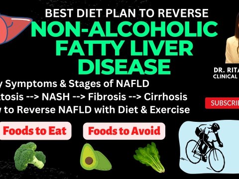Fatty Liver: Early Symptoms, Stages & Detox Diet Plan | How to Detox Your Liver & Reverse NAFLD Fatty Liver: Early Symptoms, Stages & Detox Diet Plan | How to Detox Your Liver & Reverse NAFLD
