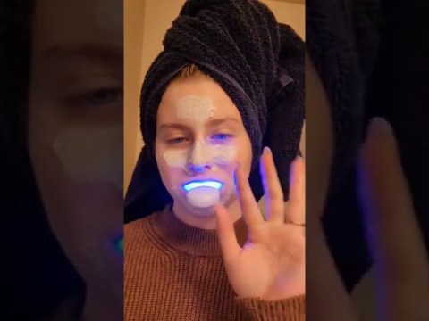 7 days of using Auraglow Teeth Whitening Kit #teethwhitening #whitenteeth #Auraglow 7 days of using Auraglow Teeth Whitening Kit #teethwhitening #whitenteeth #Auraglow