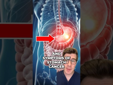 STOMACH CANCER – 9 potential signs and symptoms #shorts #health STOMACH CANCER – 9 potential signs and symptoms #shorts #health