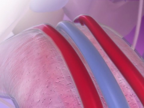 Erectile Dysfunction: Visible Body Fast Facts Erectile Dysfunction: Visible Body Fast Facts