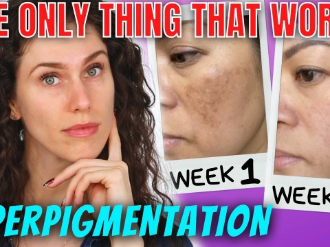 The ONLY Ingredients That Stop Hyperpigmentation (And Reverse It) The ONLY Ingredients That Stop Hyperpigmentation (And Reverse It)