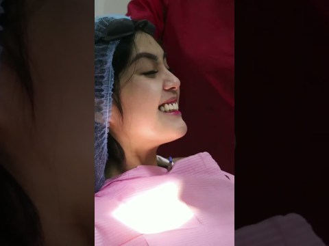 Gummy Smile No More! #DrRFD #shorts Gummy Smile No More! #DrRFD #shorts