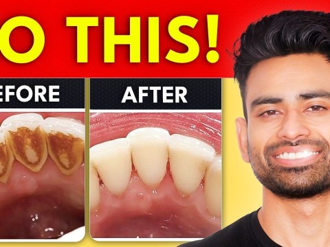 How to Remove Dental Plaque & Prevent Cavities? How to Remove Dental Plaque & Prevent Cavities?