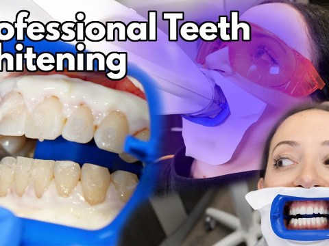 Teeth Whitening At The Dentist | Fastest Way To Whiten Your Teeth Teeth Whitening At The Dentist | Fastest Way To Whiten Your Teeth