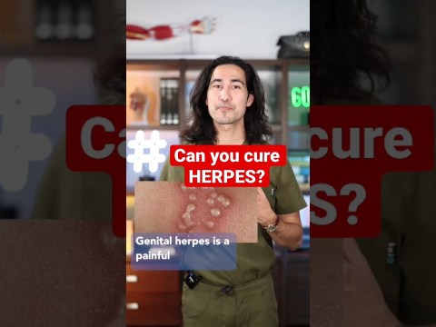 Can you CURE HERPES? Can you CURE HERPES?