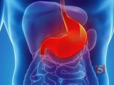 5 Natural Remedies For GERD 5 Natural Remedies For GERD