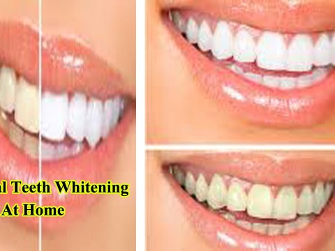 Natural Teeth Whitening At Home – How To Get Whiter Teeth Natural Teeth Whitening At Home – How To Get Whiter Teeth