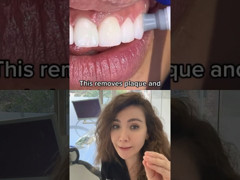 What Is Dental Polishing?! What Is Dental Polishing?!