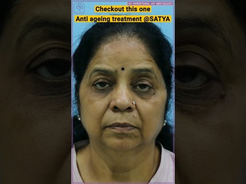 How to look young? | Anti aging treatment | Aging cream | Aging treatment | #youtubeshort #skincare How to look young? | Anti aging treatment | Aging cream | Aging treatment | #youtubeshort #skincare