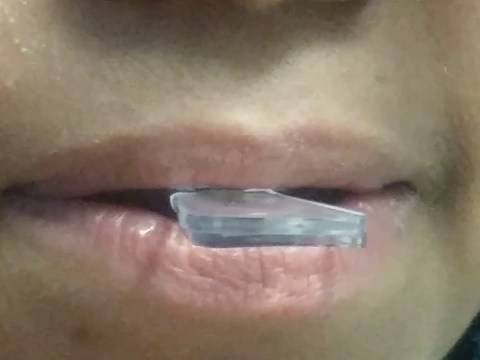 AURAGLOW TEETH WHITENING KIT AURAGLOW TEETH WHITENING KIT