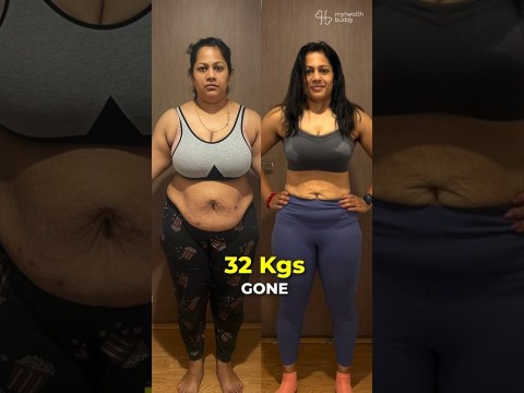 32 kgs weight loss and Belly fat and face fat gone – Thyroid and Cholesterol back to normal! 32 kgs weight loss and Belly fat and face fat gone – Thyroid and Cholesterol back to normal!