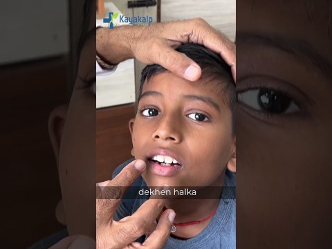 Natural Remedy for Vitiligo | Babchi Oil for Vitiligo | Kayakalp Global Natural Remedy for Vitiligo | Babchi Oil for Vitiligo | Kayakalp Global