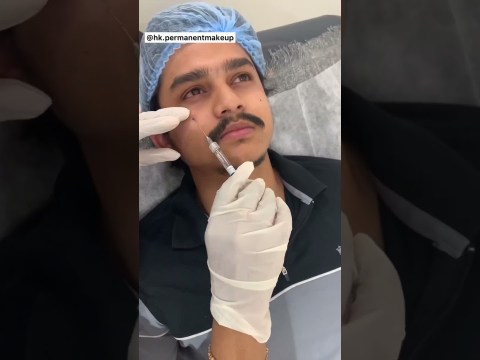 #dorasaiteja dark circle treatment at hk permanentmakeup clinic ..9052339052 Hyderabad & Vijayawada #dorasaiteja dark circle treatment at hk permanentmakeup clinic ..9052339052 Hyderabad & Vijayawada