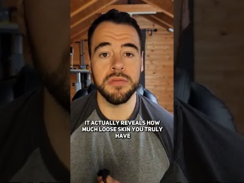 How To TIGHTEN UP Loose Skin #looseskin #weightloss #weightlossjourney #losingweight #weightloss2022 How To TIGHTEN UP Loose Skin #looseskin #weightloss #weightlossjourney #losingweight #weightloss2022