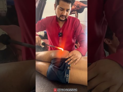 sciatica buttock pain || Agni Karma in Ayurveda || Dr.Amit Bharti Dehradun || sciatica buttock pain || Agni Karma in Ayurveda || Dr.Amit Bharti Dehradun ||