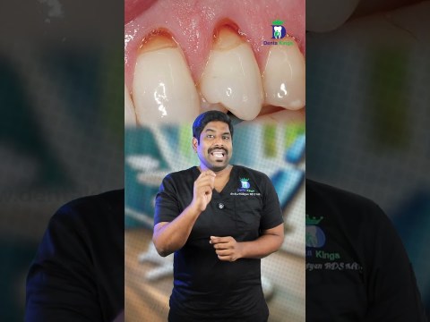 பல் சுத்தம் செய்தால் கூசுமா? Sensitivity during dental scaling | Dr.Karthikeyan | Denta Kings பல் சுத்தம் செய்தால் கூசுமா? Sensitivity during dental scaling | Dr.Karthikeyan | Denta Kings