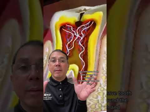 Relieving a Toothache from a Cavity with a Root Canal | In Office to Hands On Dental Training Relieving a Toothache from a Cavity with a Root Canal | In Office to Hands On Dental Training